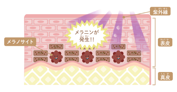 なんで日焼けやシミができるの？