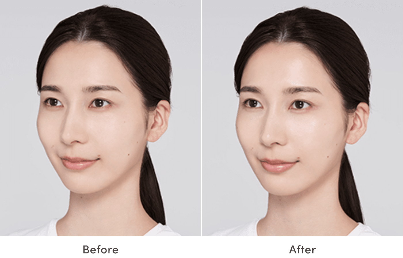 肌のbefore/afterイメージ図