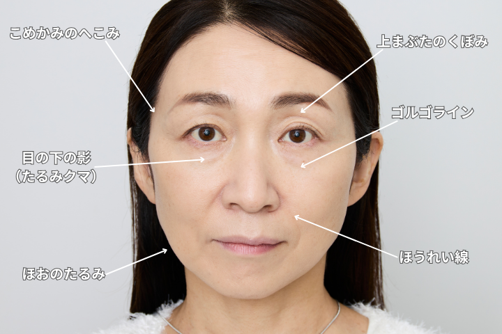 老け見えを加速させる大人のダークポイントをチェック