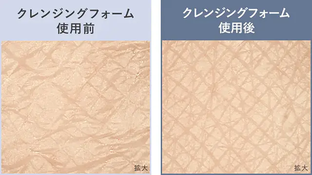 肌の拡大イメージ クレンジングフォーム使用前後の比較