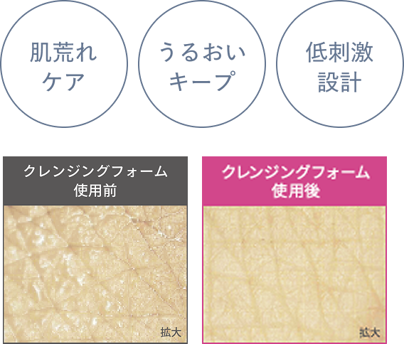 肌荒れケア うるおいキープ 低刺激設計