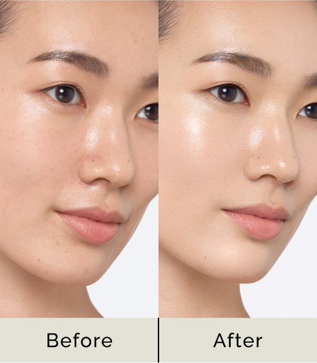 Before After