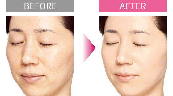 BEFORE AFTER